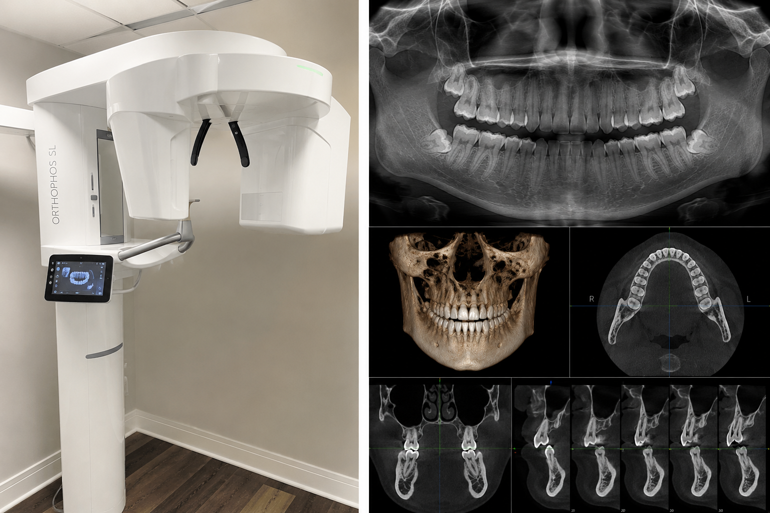 Dental 3D imaging